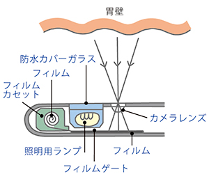 胃カメラの先端部の構造