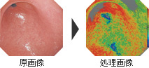 IHb分布（IHb擬似カラー表示）