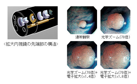 拡大内視鏡の先端部の構造