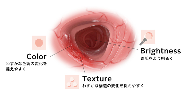 TXI(Texture and Color Enhancement Imaging）のイメージ