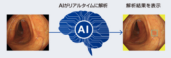 AIがリアルタイムに解析し、解析結果を表示