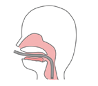経口（口から）挿入