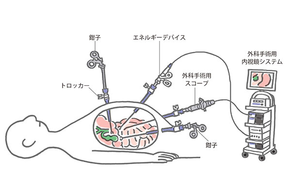 手順3～8 イメージ図