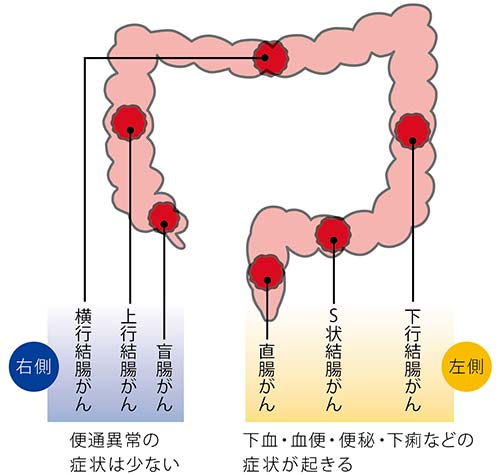 お腹 が 痛く て 下痢 する 物語