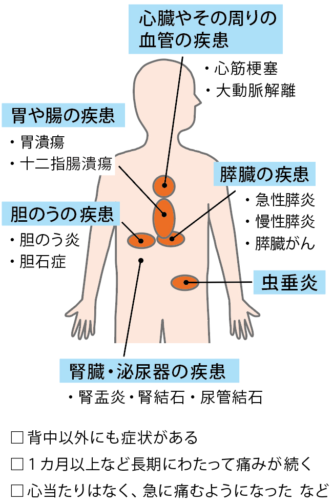 内臓疾患が疑われる背中の痛み