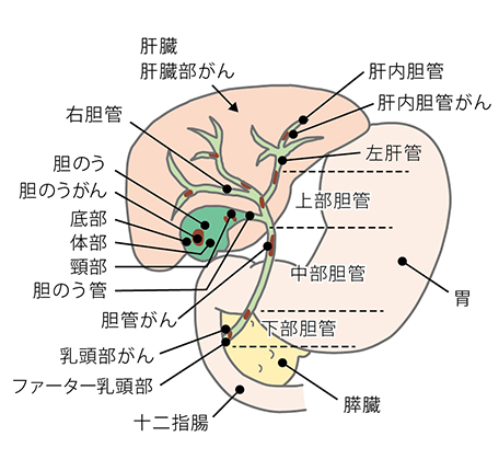 胆道とがん