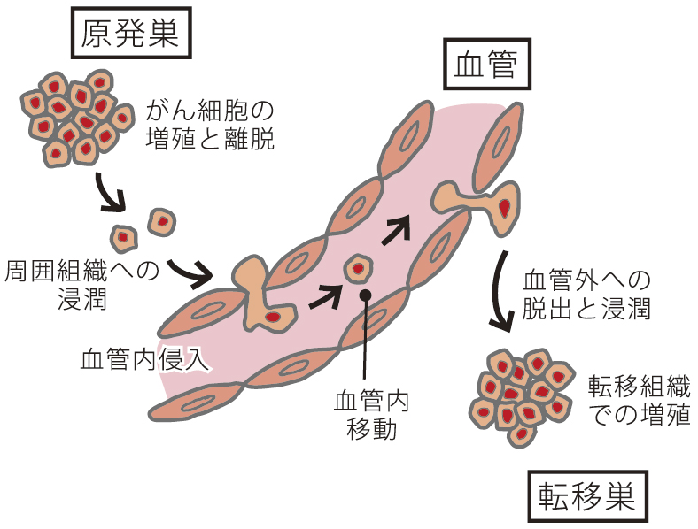 血行性転移の仕組み