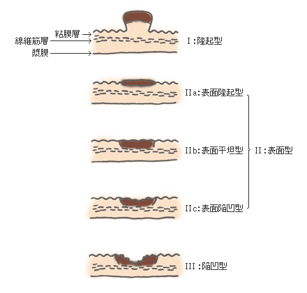 が 場所 痛み 肝臓 ん