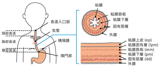 食道がんの解説と症状 オリンパス おなかの健康ドットコム