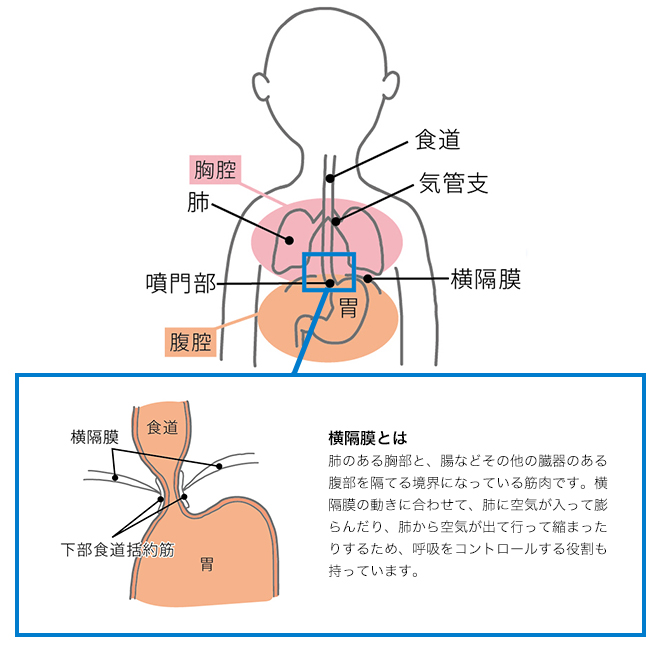 食道裂孔ヘルニア オリンパス おなかの健康ドットコム