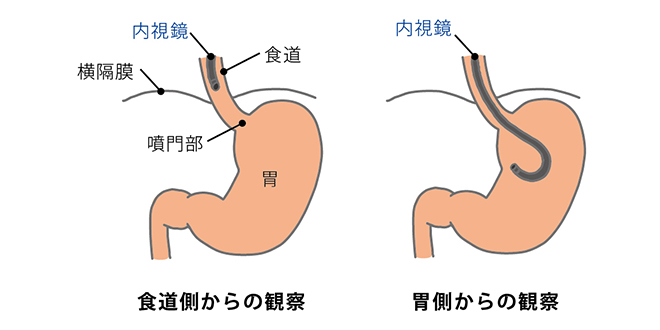 に 食後 なる 横