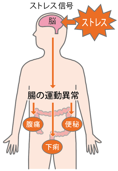 過敏性腸症候群のメカニズム