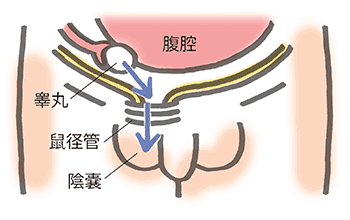 鼠径管