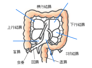 大腸がん 直腸がん 結腸がん の解説と症状 オリンパス おなかの健康ドットコム