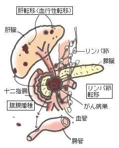 ãèµèãããèèè»¢ç§»ãã®ç»åæ¤ç´¢çµæ